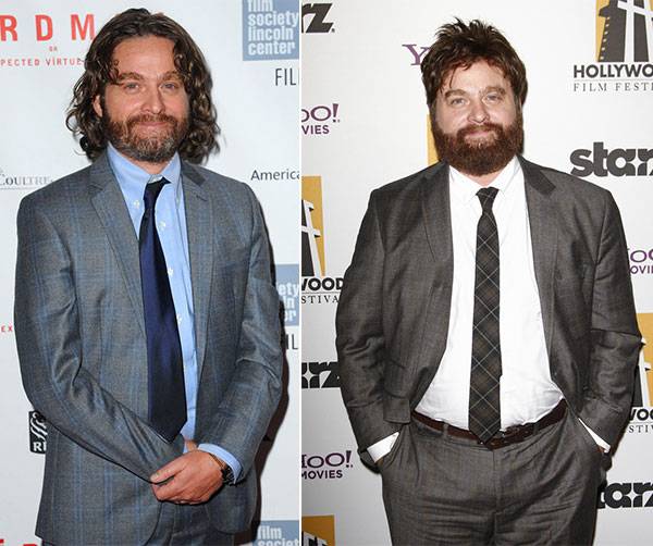 Zach Galifianakis before and after weight loss - Hollywood Celebrity Fat to Fit