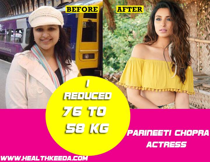 Parineeti Chopra Before and After Photo | Indian Celebrities Weight Loss