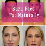 how to burn face fat naturally