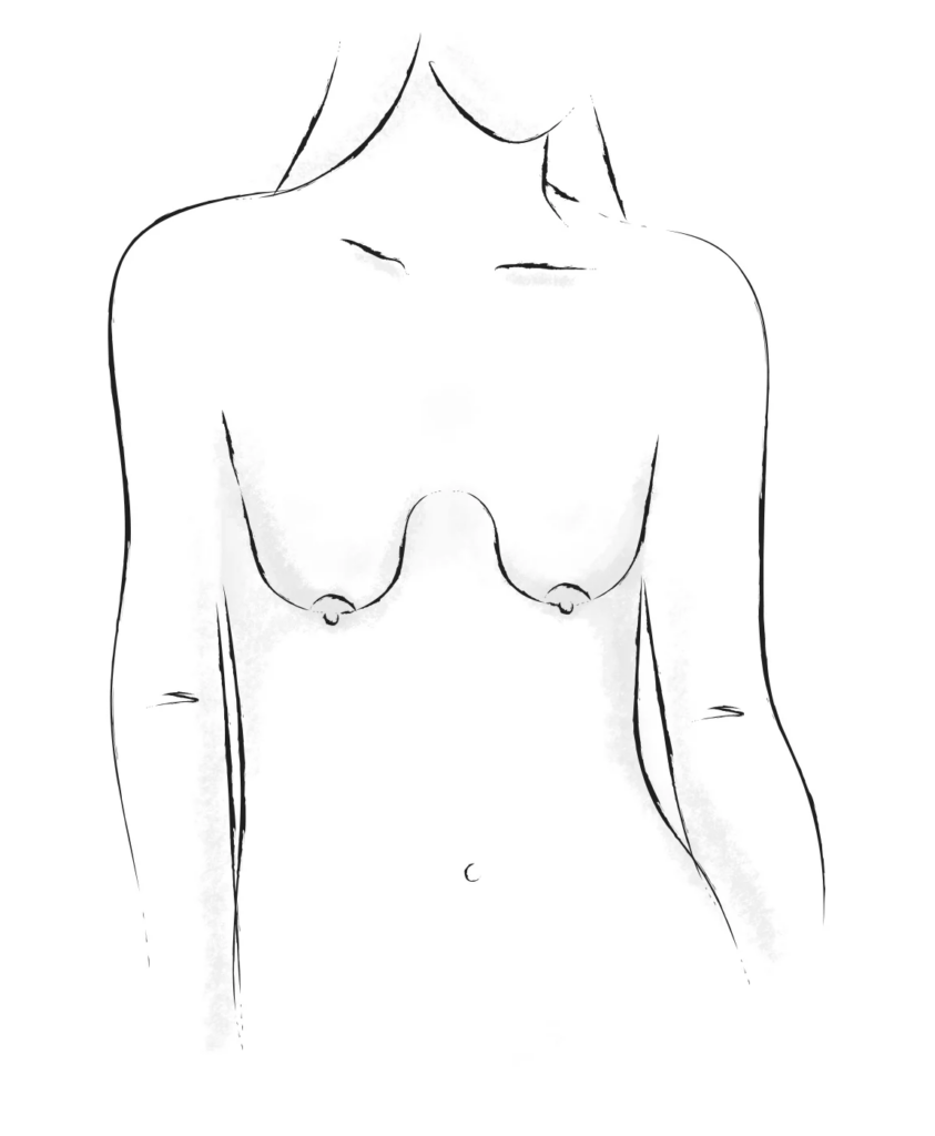  Relaxed breasts shape