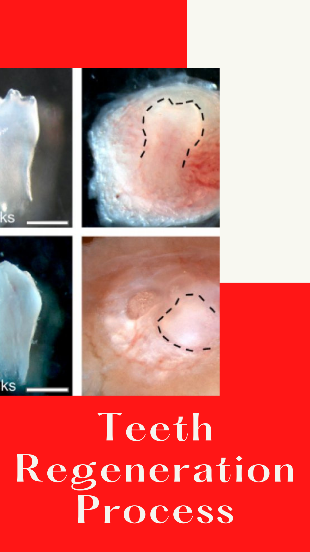 Teeth Regeneration Process