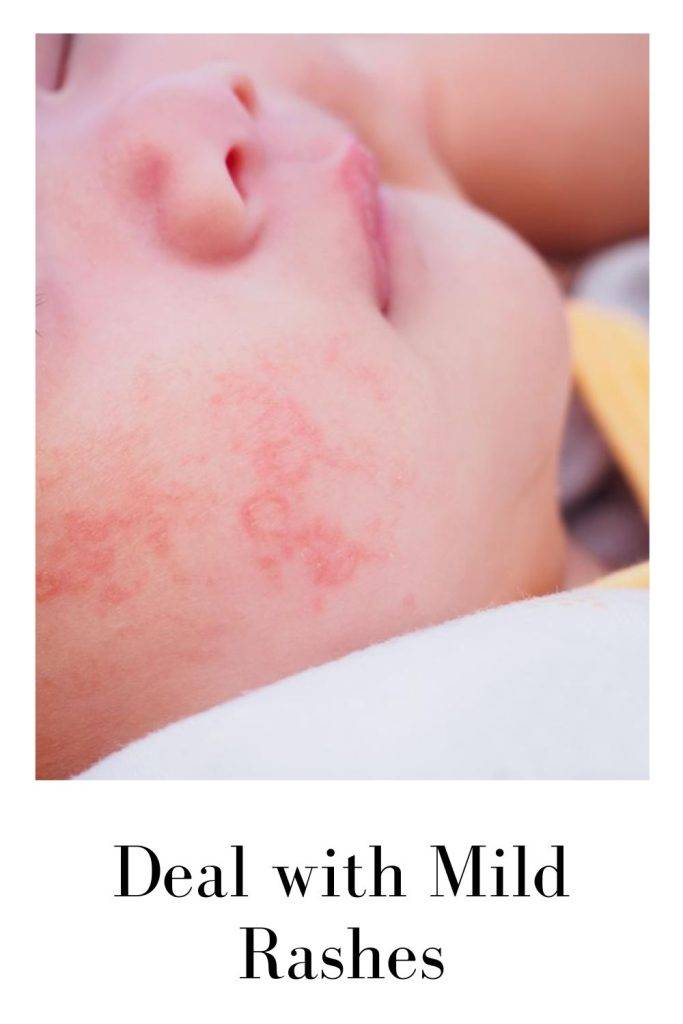 Beige chic pinterest pin child rash | Rash Rash