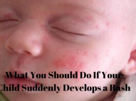 What You Should Do If Your Child Suddenly Develops a Rash