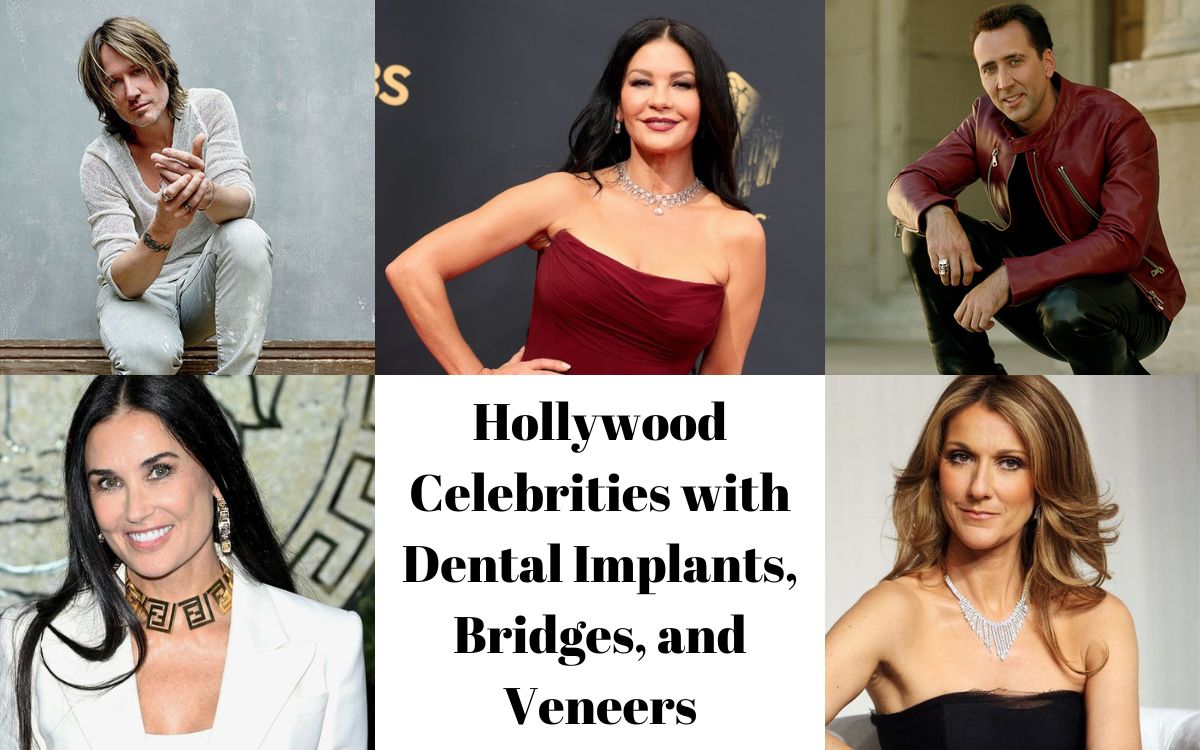 Hollywood Celebrities with Dental Implants, Bridges, and Veneers