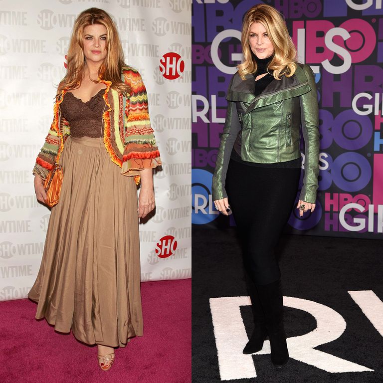 Kirstie Alley before and after pics of weight loss - celebrity weight loss secrets